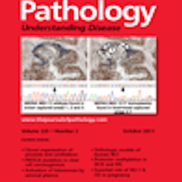 Journal of Pathology - June 2011