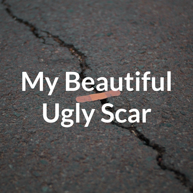 My Beautiful Ugly Scar